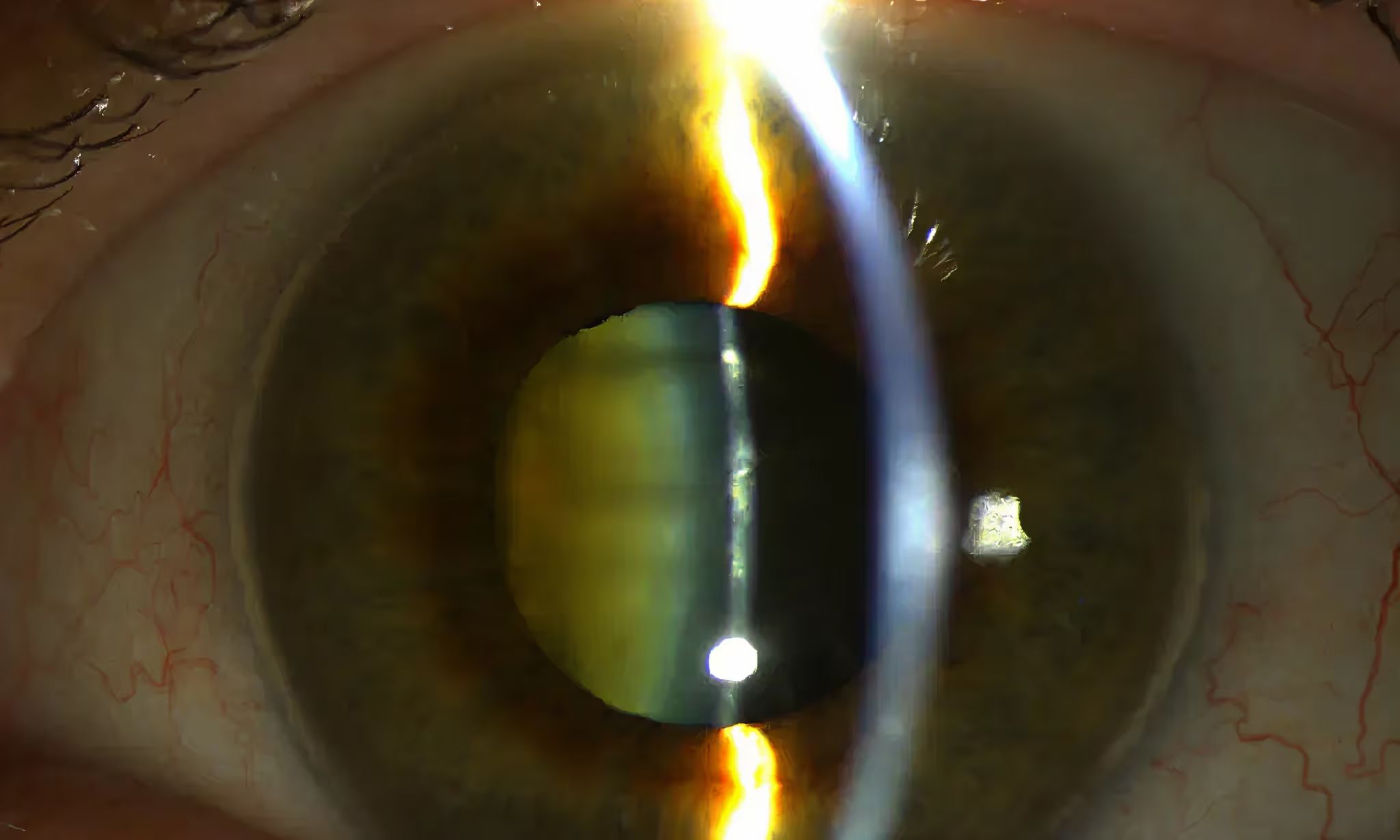 Close-up of an eye showing the iris and lens